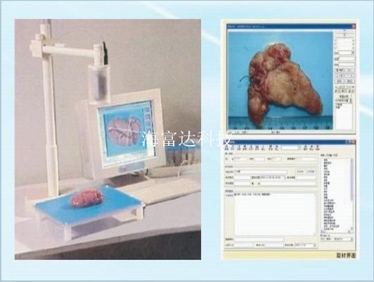 大体标本摄像系统BB9-HD-8000