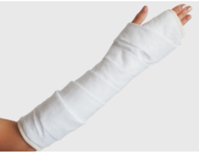 医用高分子夹板F3